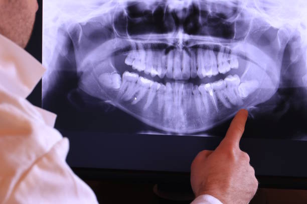 Best Emergency Dentist for Special Needs Patients in Hackberry, TX